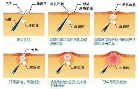 皮肤|想知道如何让肌肤常驻18岁吗？想知道明星三四十岁依然拥有靓丽肌肤吗？点进来我告诉你