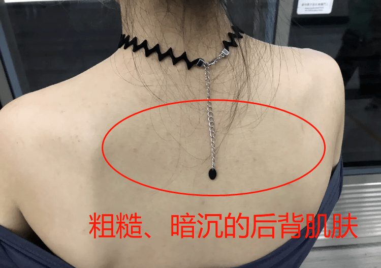 角质|薇娅吹爆的这款磨砂膏,我替你们试了,用完蚊子能在背上劈叉!