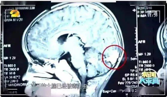 孩子|智商倒退、发育落后！ 这些错误的喂养方式是在害娃。2岁聪明宝宝被亲戚喂白酒