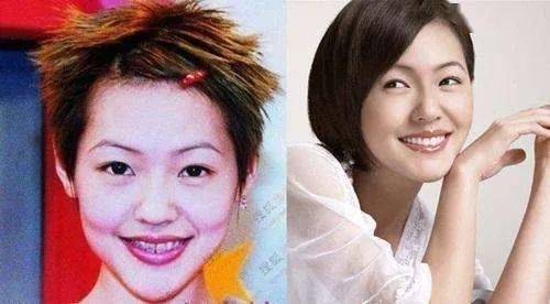 口腔|整牙比整容还要厉害？不动刀，不打针，悄悄变美的秘密就在这里！