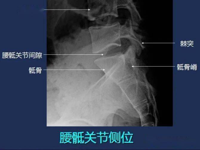 影像解剖全身常规x线骨关节mri断层解剖大全