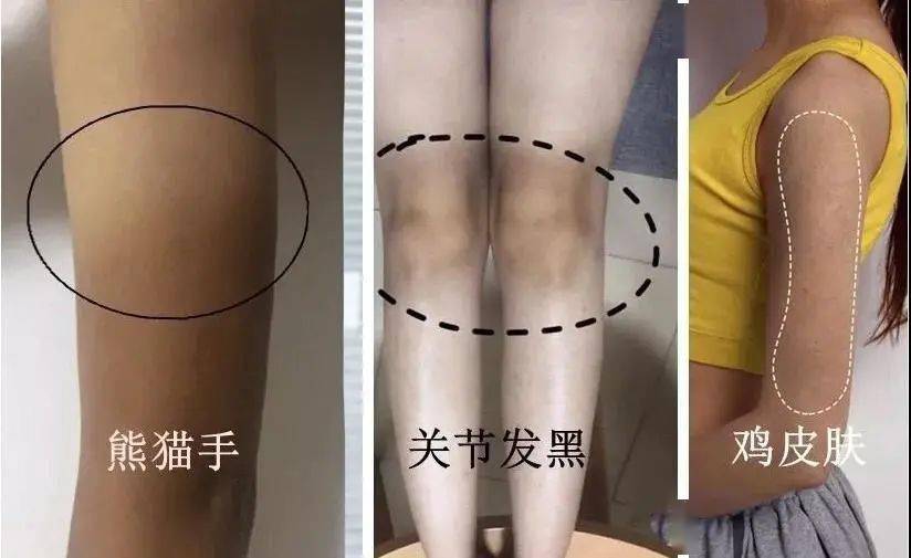 不知道|用1颗糖洗澡是什么体验？不洗都不知道身上这么脏，竟然还能扣出油脂粒！