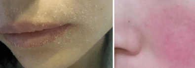 换季|吴昕、林允睡前都在用的懒人超爱保养品，一次性解决换季皮肤敏感、泛红、脱皮...