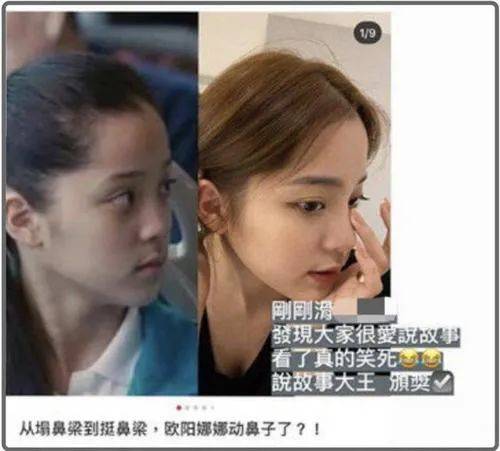 桃仔|整容黑历史都自曝了,景甜真是个狠人啊!