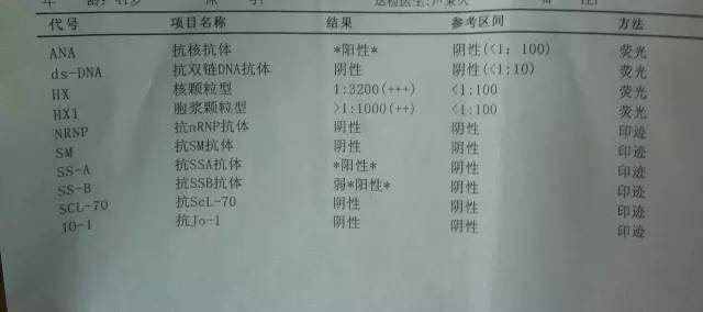 抗体|干燥综合征，这7项体检指标千万别误解！