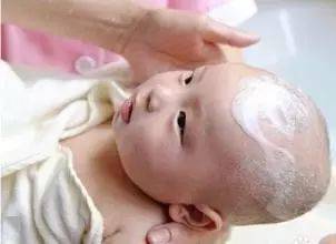 宝宝|新妈妈第一课：如何清洁新生儿的胎脂和头垢