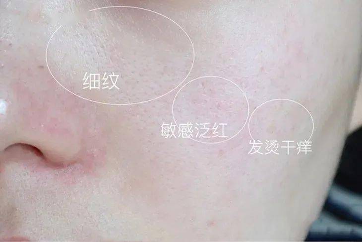 补水|这个夏日必备的俄罗斯国民面膜，百元不到就能囤满补水、清洁、美白、紧致N个功效，也太值了叭！