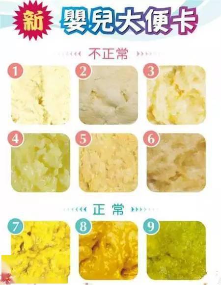 宝宝便便这9种颜色,只有3种是健康的