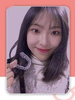 牙齿|“不会吧，不会吧，现在还有没整过牙的明星吧？”