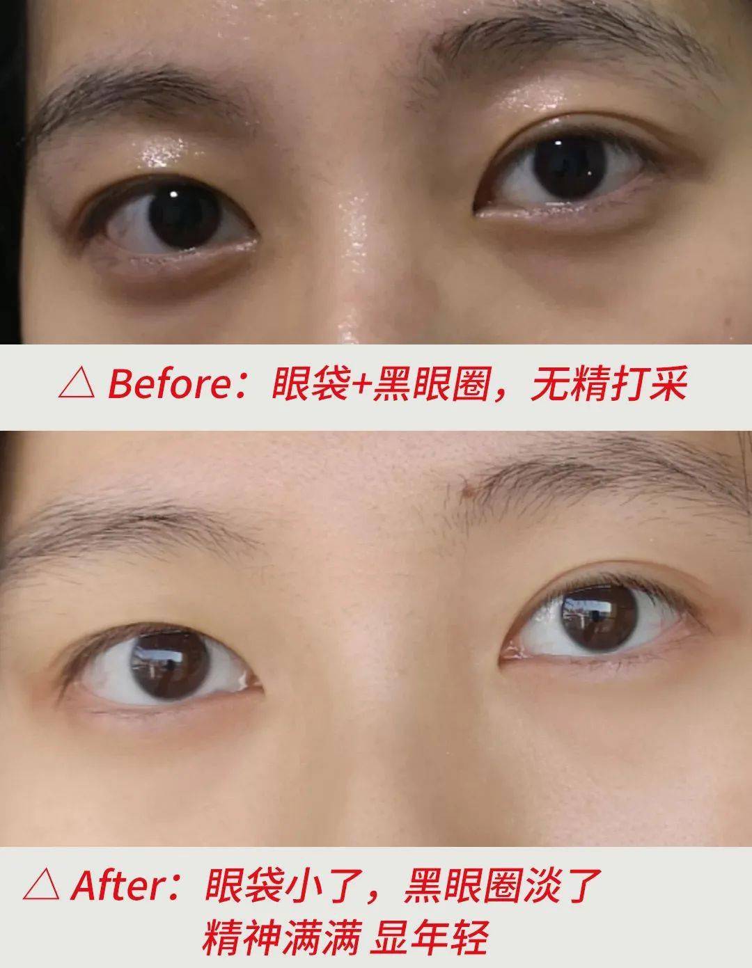 黑眼圈|blingbling大眼秘诀！早晚滚两下，赶走黑眼圈、细干纹！