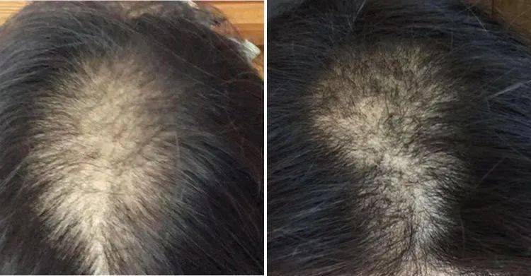 头发|大写的服！热巴居然连一根细小的发丝都不放过...