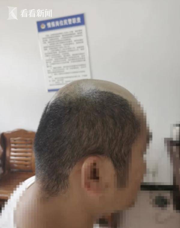 头发|为躲毒检男子自动“地中海”，民警一撸头惊到了