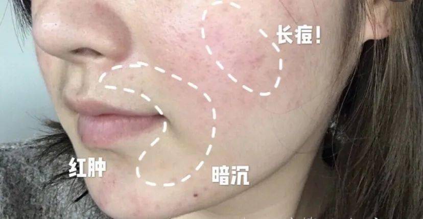 化妆品又出新科技！抗糖还防晒的美白小能手，轻松化出张慧雯的“初恋脸”！