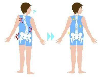 怎么看小孩子有没有驼背 815f61004e4843d781d22c37b8fb41bb.jpeg