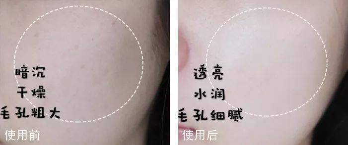 脸蛋|你的脸蛋“一键美颜”,除了滤镜还靠什么?