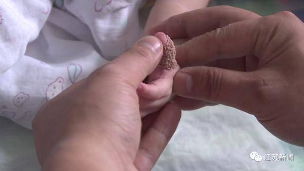 欢欢|家长用了个办法想让它脱落，结果左手差点废了…女婴多长一根指头