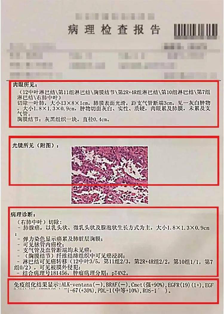 肺癌病理检查报告很重要你却读不懂