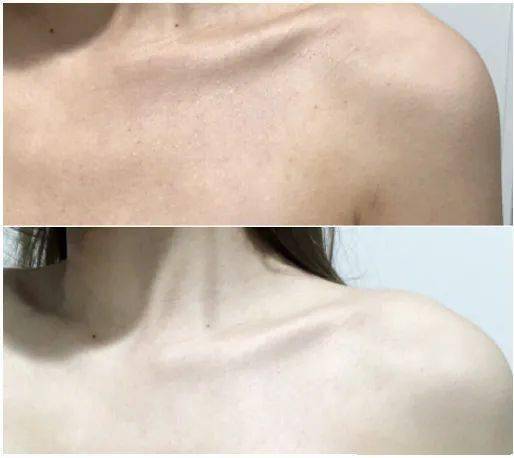 皮肤|白到发光的张雨绮性感冲出屏幕!这次成了“直女斩”