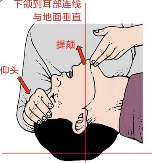 应急救护实践团急救小课堂之cpr