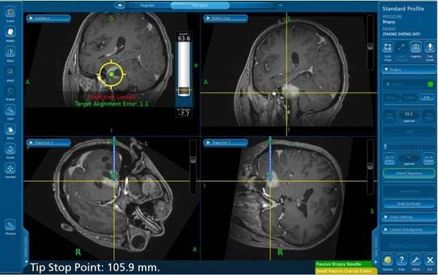诊断|脑科学发展进入黄金时代，高精尖医疗器械市场巨大
