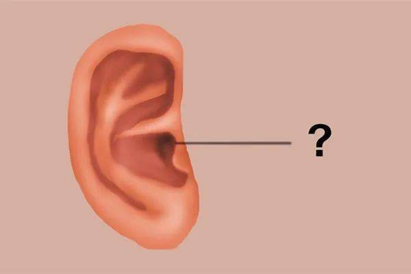 为什么有人是油耳朵，有人是干耳朵？有哪些区别？