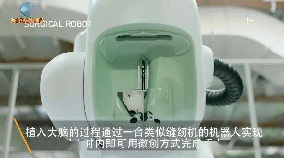 马斯克|马斯克的“脑机接口”火了