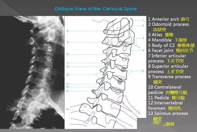 超详细的腰椎x线解剖及解读