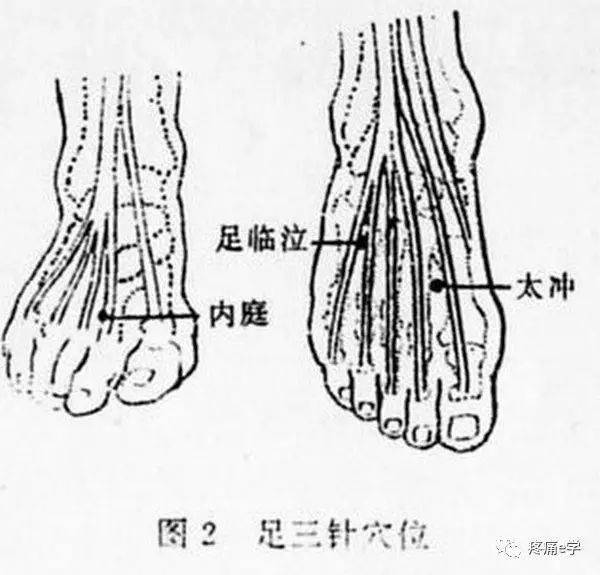 手三针足三针肩三针