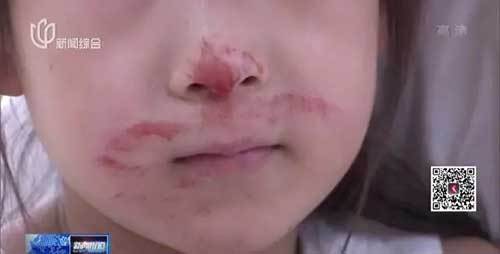 上海阿婆和孙女被十几楼坠下的重物砸伤，血洒