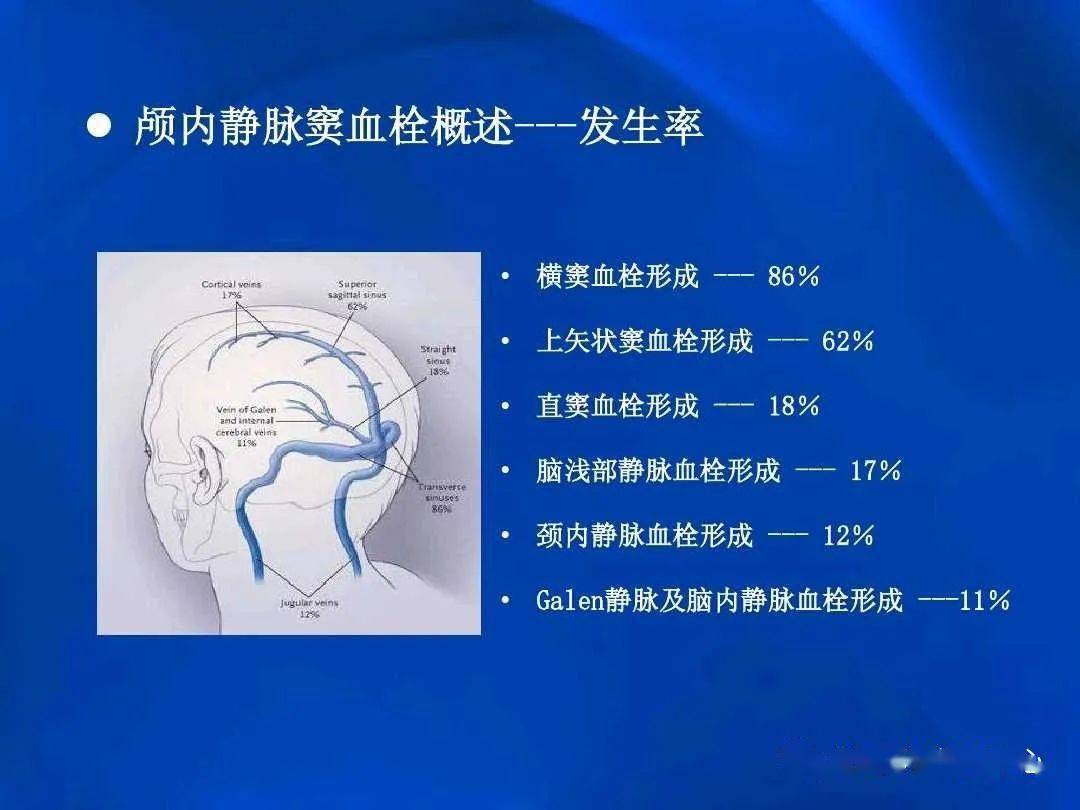 颅内静脉窦血栓形成的影像学表现