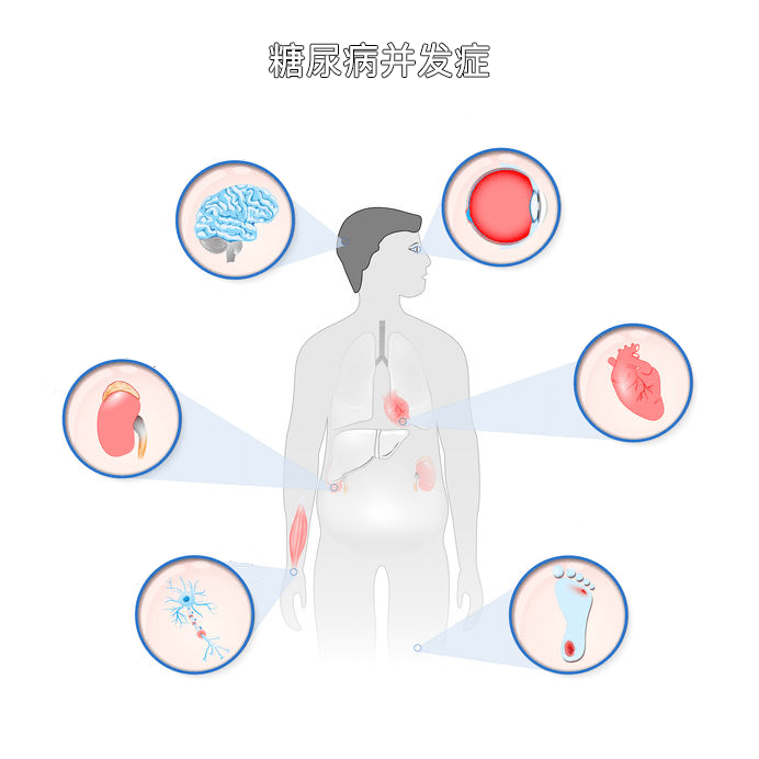 指标|宣医科普|一分钟看懂『三高』检查报告