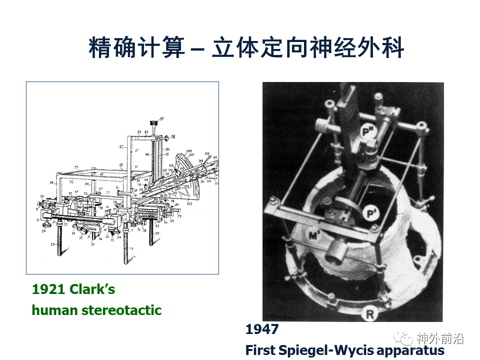 神经|智慧神外 | 天坛医院赵元立：大数据时代的神经医学发展