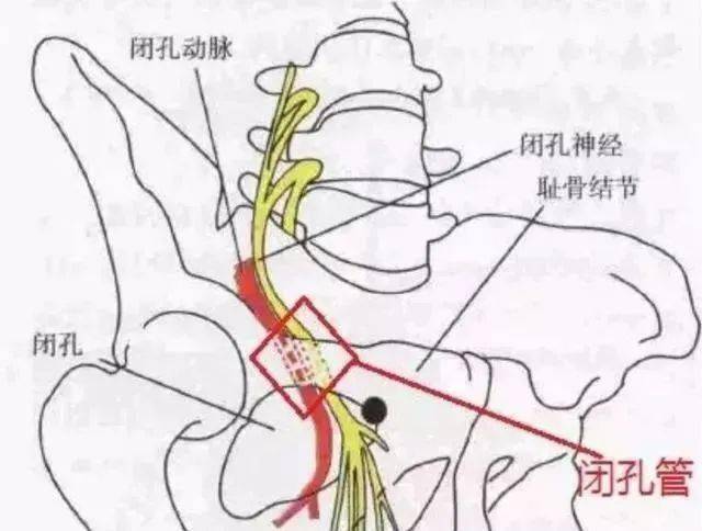 膝关节位置的疼痛第二大凶手就是这根神经