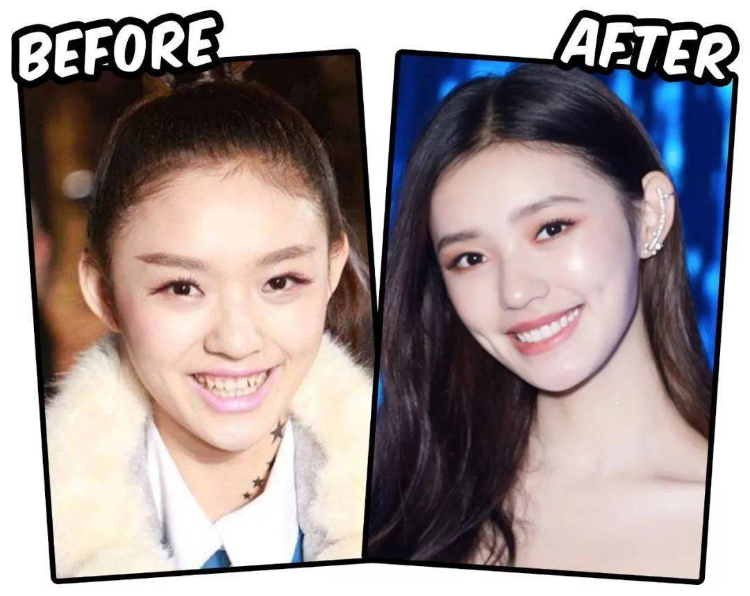 姑娘|姑娘，你的笑起来真的好美。