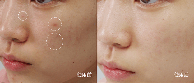 水宝宝|日本家庭主妇最爱的懒人面霜！3分钟让大干皮变成“水宝宝”！每7秒卖出一瓶，李佳琦疯狂打call！