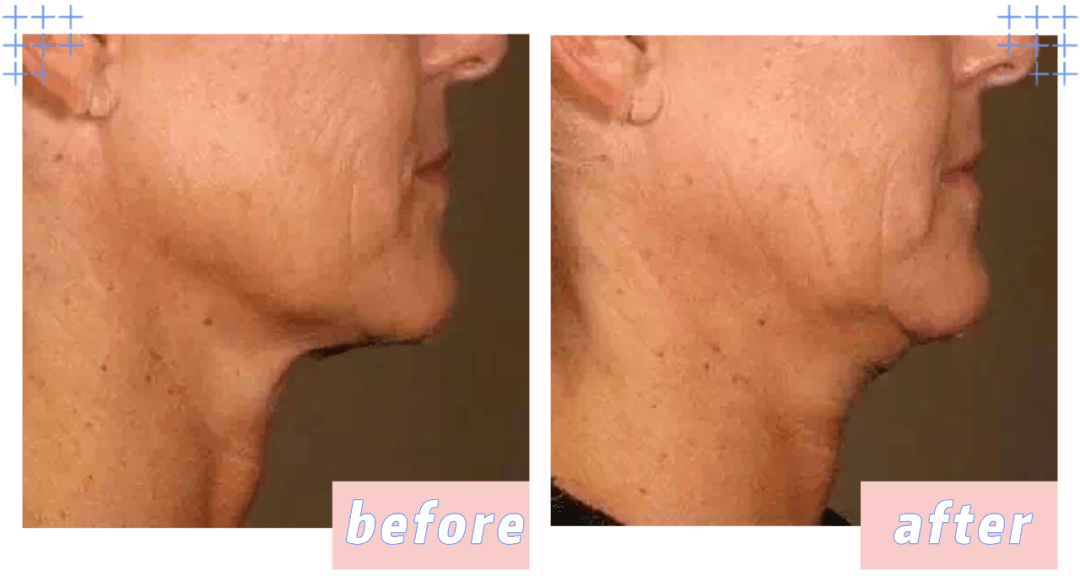 产品|为什么你的脸越来越大？原来都是因为这一点没做好？