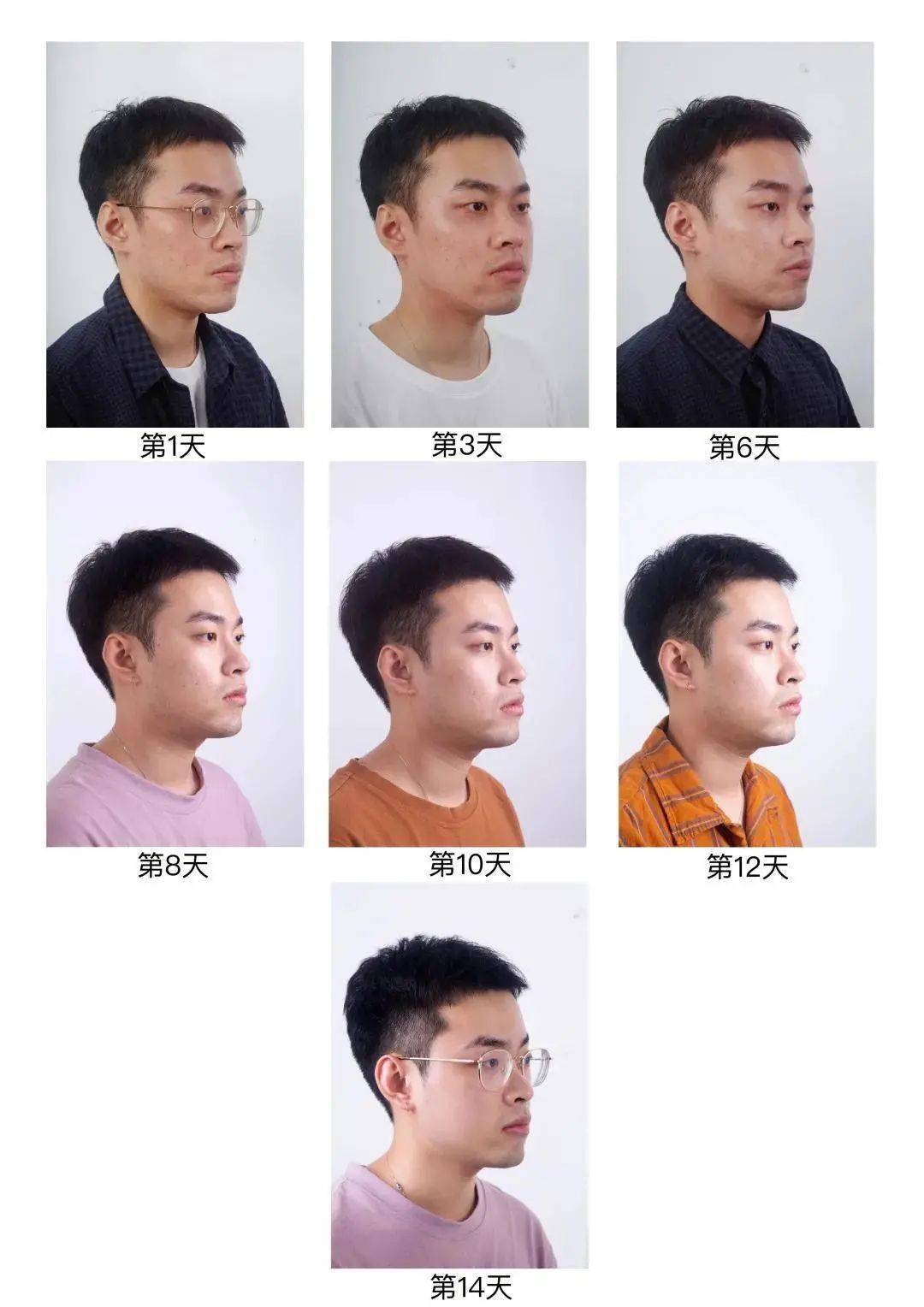 贫民窟|杨幂熬夜后护肤要花2万块？怪不得皮肤吹弹可破！贫民窟女孩就不配消除熬夜痘、黑眼圈吗？