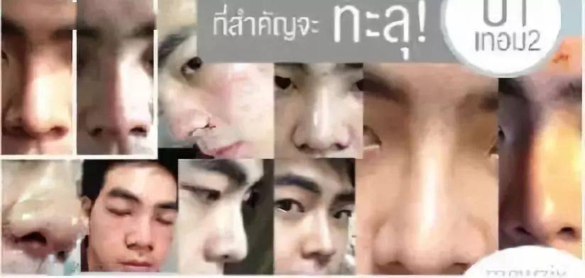 生活|泰国小哥花15万整形，成功从屌丝逆袭变男神！