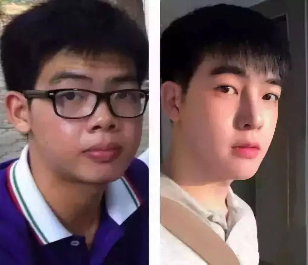 生活|泰国小哥花15万整形，成功从屌丝逆袭变男神！