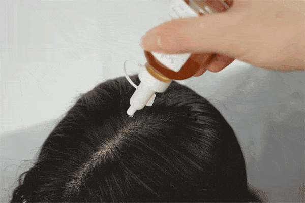 索芙特|原来发际线后移还能这样遮!我终于可以拥有“海藻头”啦