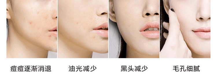 贫民窟|杨幂熬夜后护肤要花2万块？怪不得皮肤吹弹可破！贫民窟女孩就不配消除熬夜痘、黑眼圈吗？