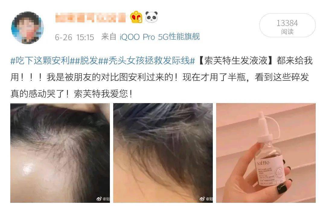 索芙特|原来发际线后移还能这样遮!我终于可以拥有“海藻头”啦