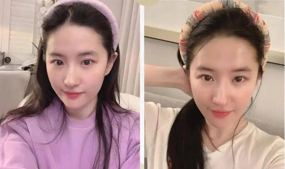 贫民窟|杨幂熬夜后护肤要花2万块？怪不得皮肤吹弹可破！贫民窟女孩就不配消除熬夜痘、黑眼圈吗？