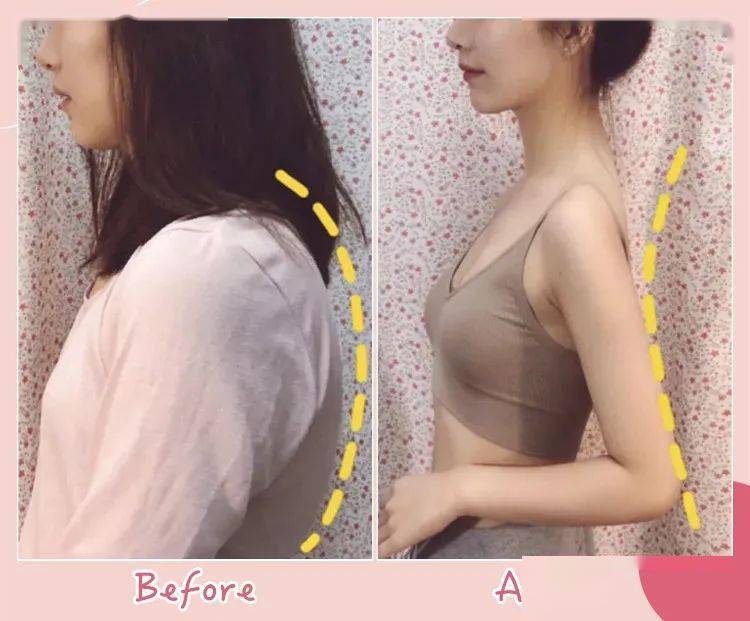 智商|张雨绮的矫姿带到底是智商税，还是真女神制造机？