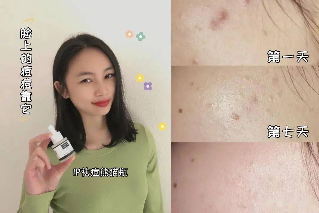 贫民窟|杨幂熬夜后护肤要花2万块？怪不得皮肤吹弹可破！贫民窟女孩就不配消除熬夜痘、黑眼圈吗？