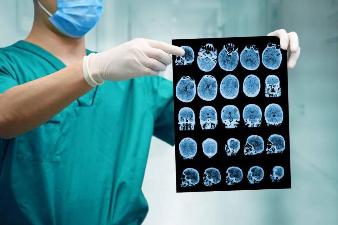 小脑|【市中医|科普】中医中药治“小脑梗”