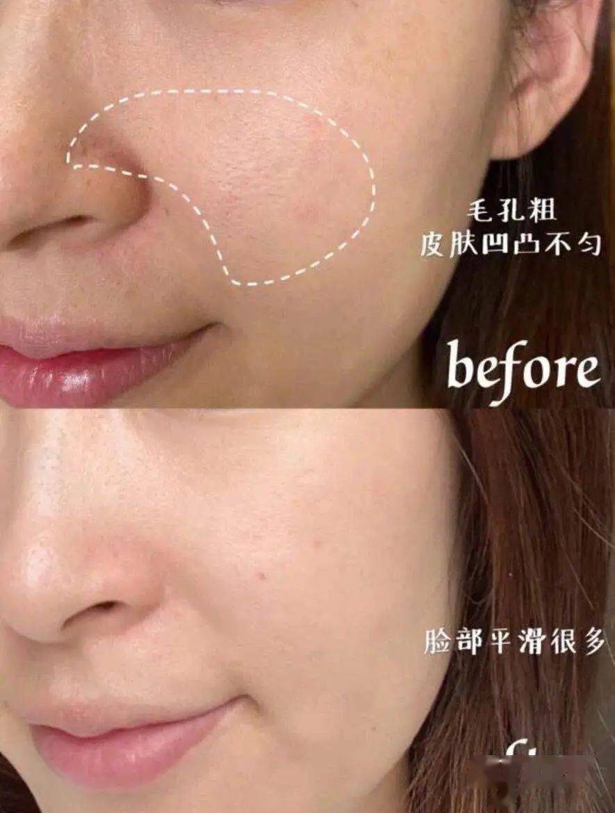 潘达|日本20年老木头,经1300°高温烧成“变态黑炭”,几分钟溶掉黑头,太神奇!