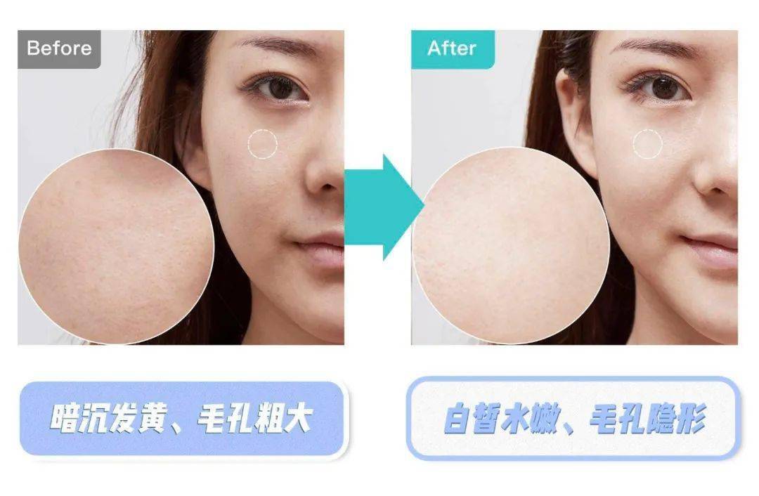 小气泡|花9块钱在福州这家店做了医美,做完就后悔了!