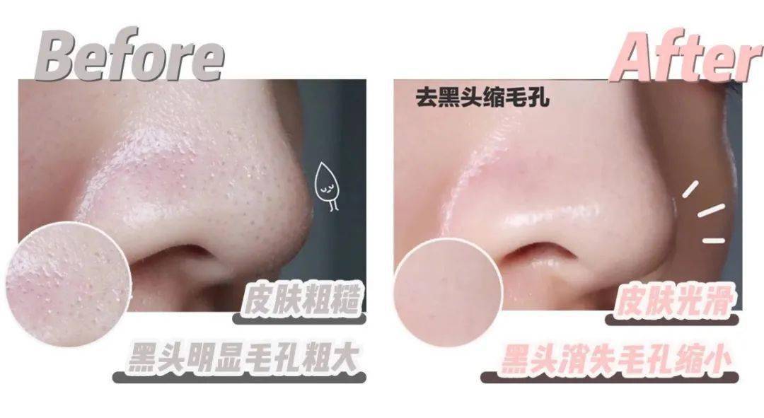 小气泡|花9块钱在福州这家店做了医美,做完就后悔了!