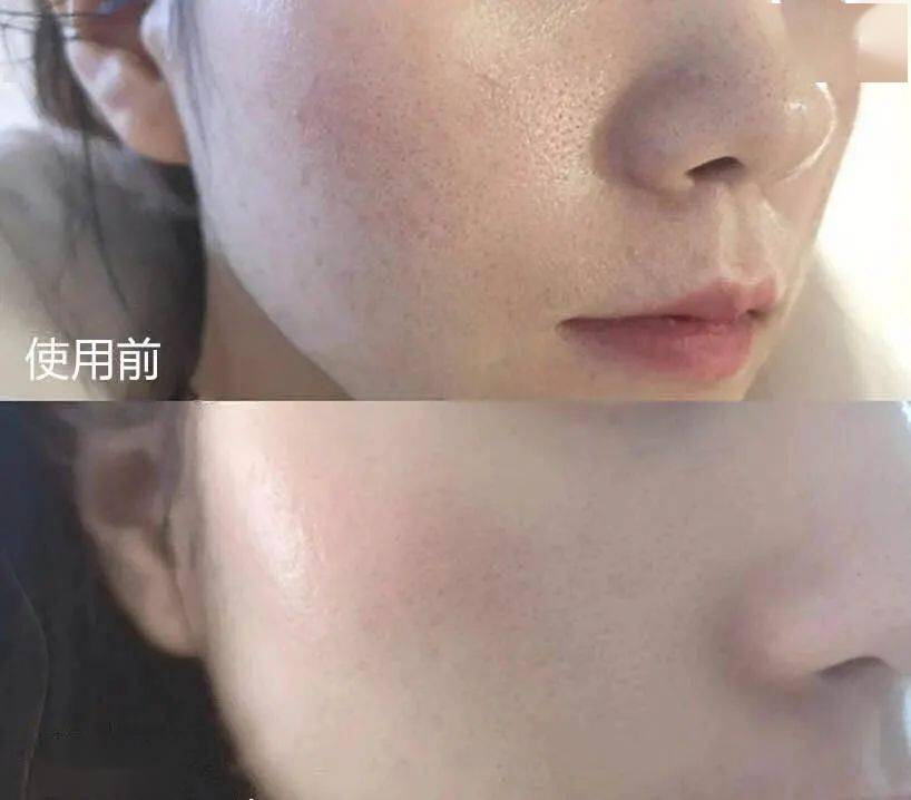 潘达|日本20年老木头,经1300°高温烧成“变态黑炭”,几分钟溶掉黑头,太神奇!